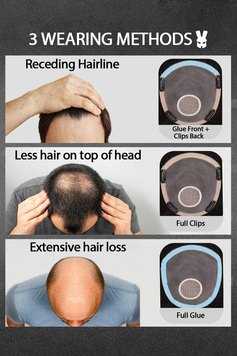 Illustration showing three methods of wearing hairpieces for different hair loss scenarios.